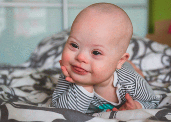 En busca de personas con síndrome de down en las zonas urbana y rural de Tuluá
