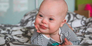 En busca de personas con síndrome de down en las zonas urbana y rural de Tuluá