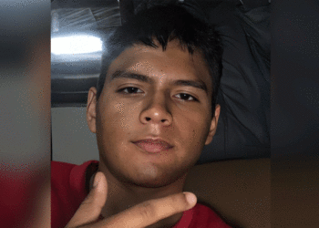 Fallece joven motociclista; el accidente se registró en la Doble Calzada