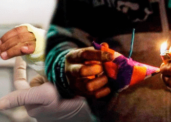 Tuluá inició diciembre con cuatro personas quemadas con pólvora