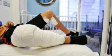 A 82 ya llegó el número de personas quemadas en el Valle del Cauca