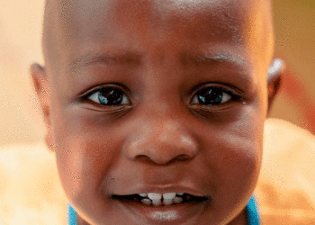 No hay cifras actualizadas de desnutrición en Tuluá; la última medición se hizo en el 2022