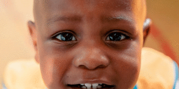 No hay cifras actualizadas de desnutrición en Tuluá; la última medición se hizo en el 2022