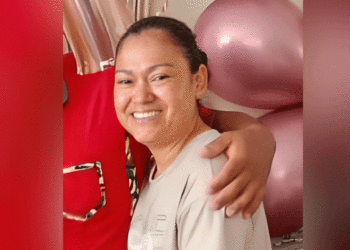 FaIIeció mujer que resultó quemada en incendio de vivienda en el barrio Diablos Rojos