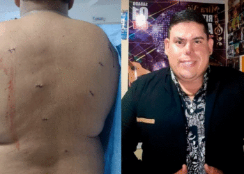 Artista tulueño fue robado y herido de manera violenta