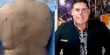 Artista tulueño fue robado y herido de manera violenta