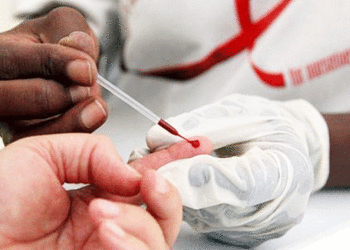 Atención a medias a pacientes con Sida; la problemática se registra en varios municipios