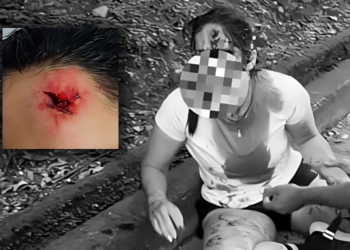 Agresión a deportista en la vía hacia El Picacho genera preocupación