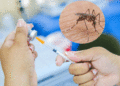 Fiebre amarilla mantiene en alerta a las autoridades de salud
