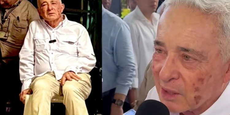 Aspecto del expresidente Álvaro Uribe Vélez genera comentarios en redes