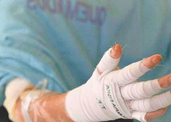 Tuluá inicia diciembre con primeros casos de quemados por pólvora