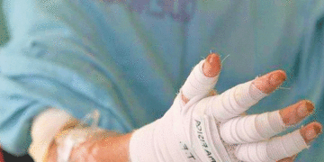 Tuluá inicia diciembre con primeros casos de quemados por pólvora