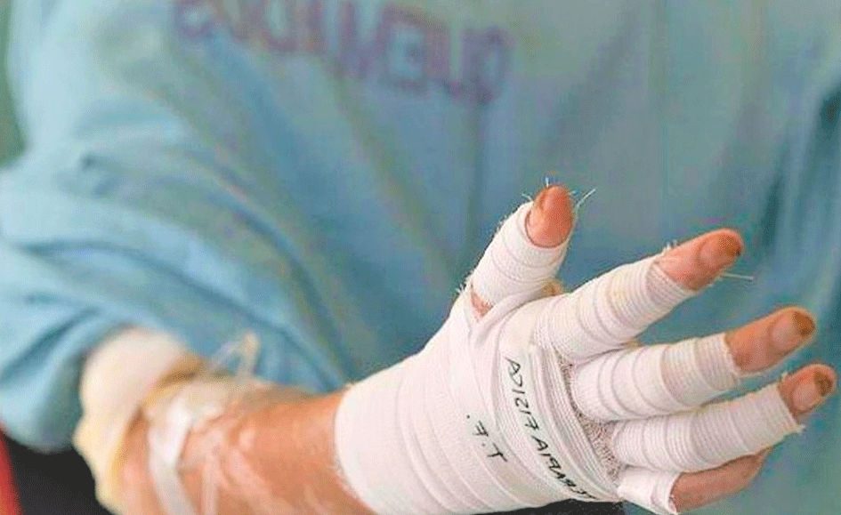 Tuluá inicia diciembre con primeros casos de quemados por pólvora