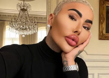 Muere Jordan James Parke, el influencer que buscó parecerse a Kim Kardashian