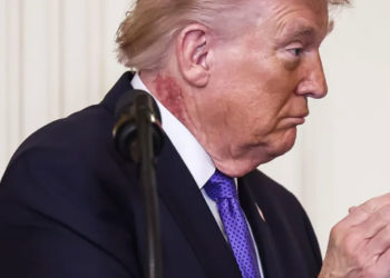 Trump reaparece con lesión visible y aviva discusión sobre su salud