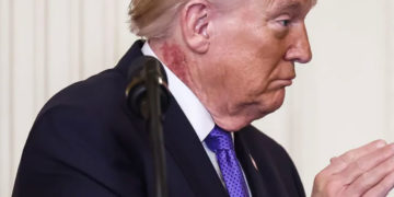 Trump reaparece con lesión visible y aviva discusión sobre su salud