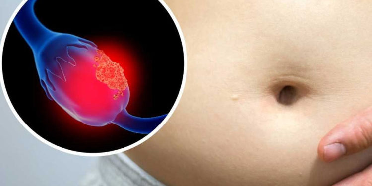 El cáncer de ovario podría detectarse antes si se identifican estos síntomas