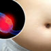 El cáncer de ovario podría detectarse antes si se identifican estos síntomas