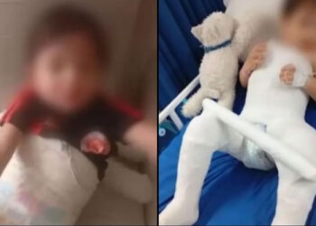 Madre dejó a su hijo en un jardín y se lo devolvieron con una pierna fracturada