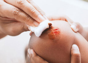 Heridas y hemorragias: recomendaciones clave para actuar correctamente