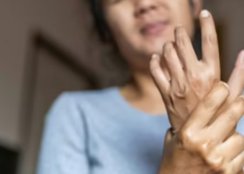 Las bacterias de la boca podrían influir en la artritis