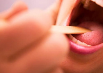 Las señales en su lengua que podrían indicar que necesita una revisión médica